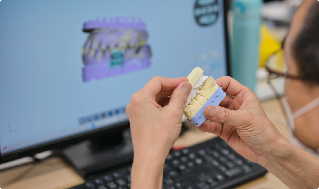 歯科技工 デジタル設計の様子