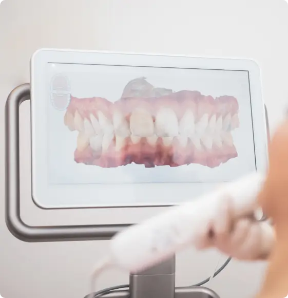 IOSラボ登録方法のイメージ